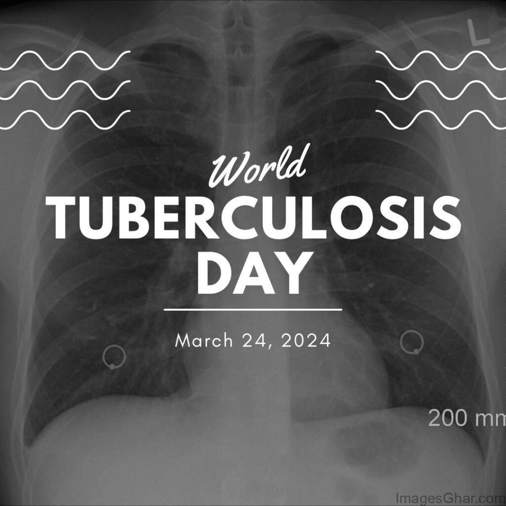 World TB Day images